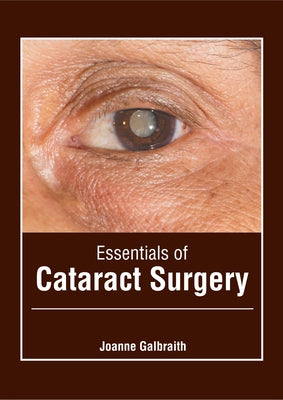 Essentials of Cataract Surgery by Galbraith, Joanne