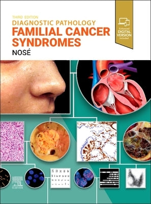 Diagnostic Pathology: Familial Cancer Syndromes by Nos?, Vania