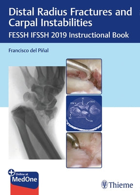 Distal Radius Fractures and Carpal Instabilities: Fessh Ifssh 2019 Instructional Book by Pinal, Francisco