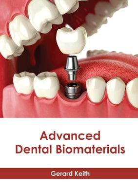 Advanced Dental Biomaterials by Keith, Gerard