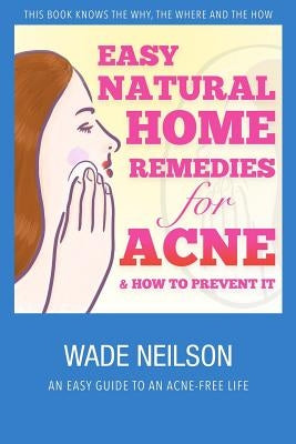 Acne: Easy Natural Home Remedies for Acne & How to Prevent It by Neilson, Wade