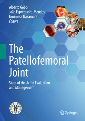 The Patellofemoral Joint: State of the Art in Evaluation and Management by Gobbi, Alberto