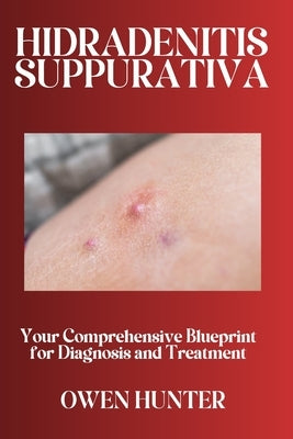 Hidradenitis Suppurativa: Your Comprehensive Blueprint for Diagnosis and Treatment by Hunter