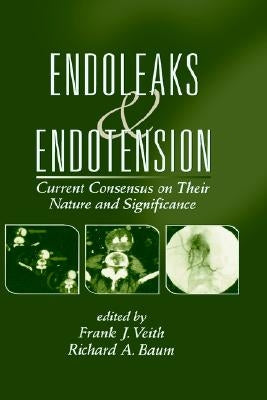Endoleaks and Endotension: Current Consensus on Their Nature and Significance by Veith, Frank J.