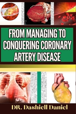 From Managing to Conquering Coronary Artery Disease: Expert Guide To Understanding The Causes, Recognizing Symptoms, And Implementing Effective Treatm by Daniel, Dashiell