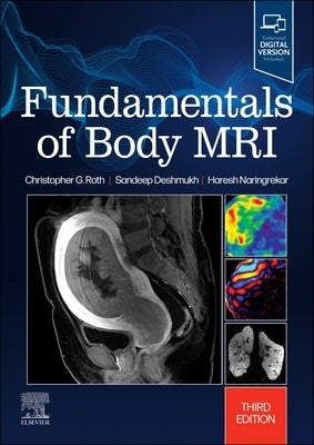 Fundamentals of Body MRI by Roth, Christopher G.