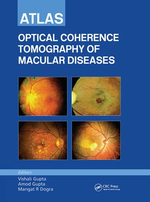 Atlas of Optical Coherence Tomography of Macular Diseases by Gupta, Vishali
