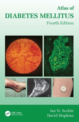 Atlas of Diabetes Mellitus by Scobie, Ian N.