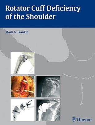 Rotator Cuff Deficiency of the Shoulder by Frankle, Mark
