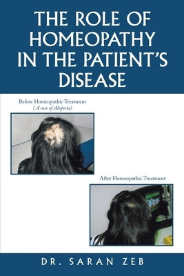 The Role of Homeopathy in the Patient's Disease by Zeb, Saran