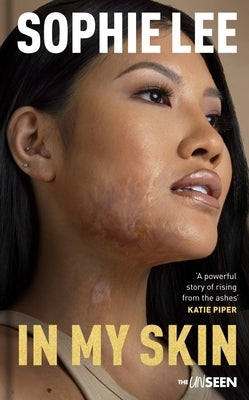 In My Skin: Learning to Love Your Perfectly Imperfect Life by Lee, Sophie