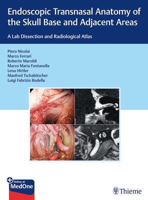 Endoscopic Transnasal Anatomy of the Skull Base and Adjacent Areas: A Lab Dissection and Radiological Atlas by Nicolai, Piero