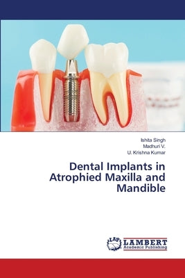 Dental Implants in Atrophied Maxilla and Mandible by Singh, Ishita