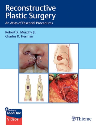 Reconstructive Plastic Surgery: An Atlas of Essential Procedures by Murphy, Robert