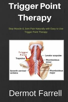 Trigger Point Therapy: Stop Muscle & Joint Pain Naturally with Easy to use Trigger Point Therapy by Farrell, Dermot