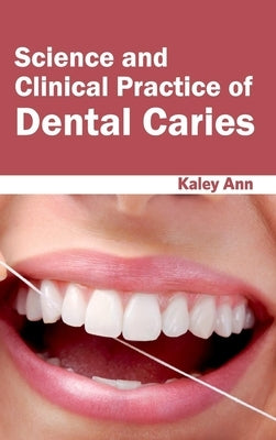 Science and Clinical Practice of Dental Caries by Ann, Kaley