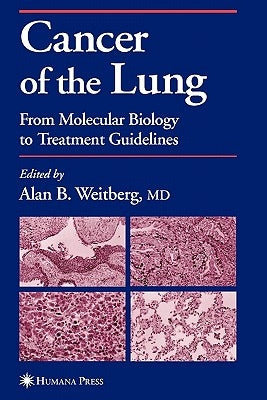 Cancer of the Lung: From Molecular Biology to Treatment Guidelines by Weitberg, Alan
