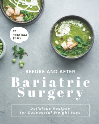 Before and After Bariatric Surgery: Delicious Recipes for Successful Weight Loss by Tosch, Christina