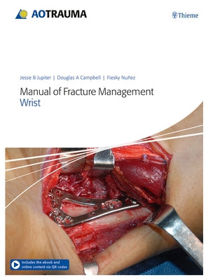 Manual of Fracture Management - Wrist by Jupiter, Jesse B.