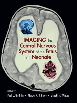 Imaging the Central Nervous System of the Fetus and Neonate by Griffiths, Paul D.