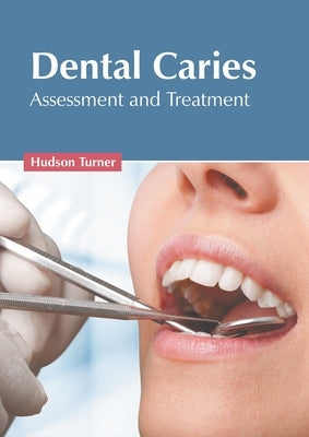 Dental Caries: Assessment and Treatment by Turner, Hudson