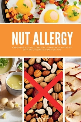 Nut Allergy: A Beginner's Guide to Tree Nut and Peanut Allergies, with Safe Recipes & Practical Tips by Kwon, Isadora