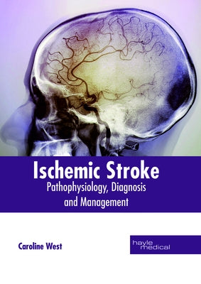 Ischemic Stroke: Pathophysiology, Diagnosis and Management by West, Caroline