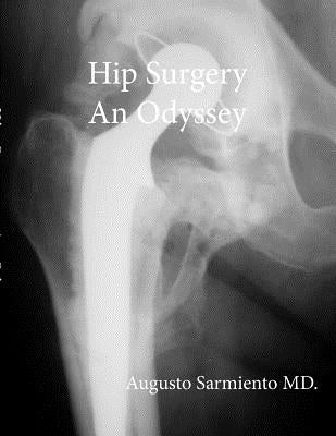 Hip Surgery - An Odyssey by Sarmiento, Augusto