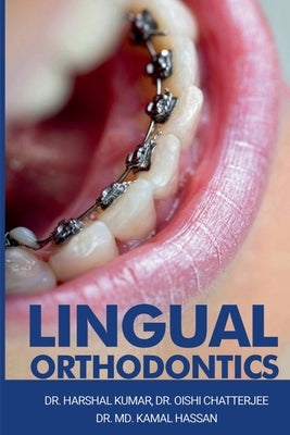 Lingual Orthodontics by Harshal, Kumar