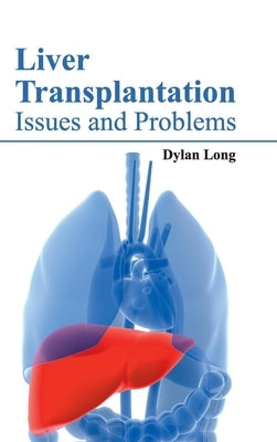 Liver Transplantation: Issues and Problems by Long, Dylan