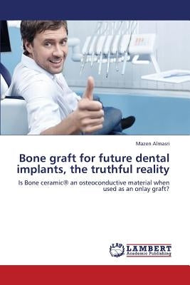 Bone Graft for Future Dental Implants, the Truthful Reality by Almasri Mazen