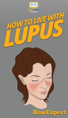 How To Live With Lupus: Your Step By Step Guide To Living With Lupus by Howexpert