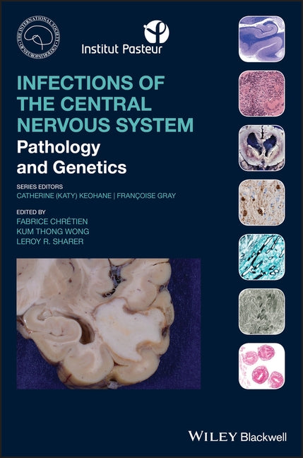 Infections of the Central Nervous System by Chretien, Fabrice