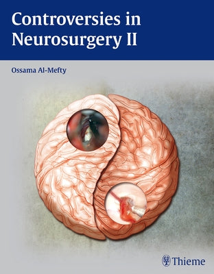 Controversies in Neurosurgery II by Al-Mefty, Ossama