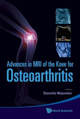 Adv in MRI of the Knee for Osteoarthriti by Blumenfeld, Janet