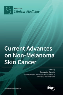 Current Advances on Non-Melanoma Skin Cancer by Caruntu, Constantin