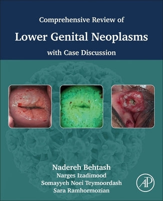 Comprehensive Review of Lower Genital Neoplasms: With Case Discussion by Behtash, Nadereh