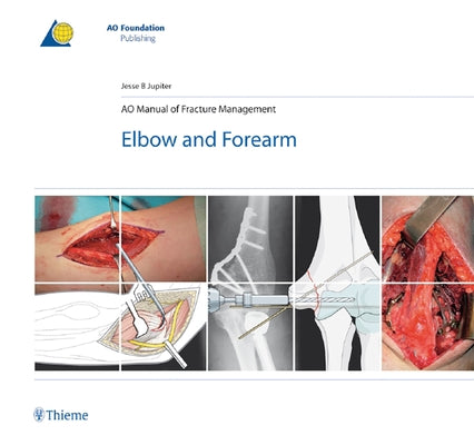 Ao Manual of Fracture Management - Elbow & Forearm by Jupiter, Jesse