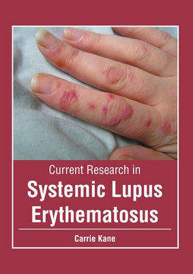 Current Research in Systemic Lupus Erythematosus by Kane, Carrie