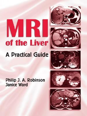 MRI of the Liver: A Practical Guide by Robinson, Philip J. a.