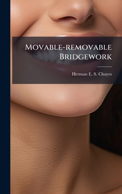 Movable-removable Bridgework by Herman E S Chayes