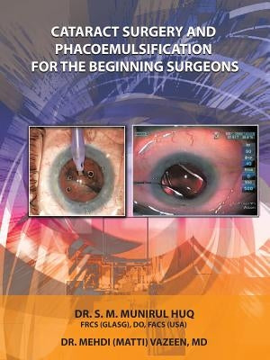 Cataract Surgery And Phacoemulsification For The Beginning Surgeons by Huq, Dr S. M. Munirul