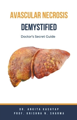 Avascular Necrosis Demystified: Doctor's Secret Guide by Kashyap, Ankita