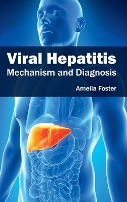 Viral Hepatitis: Mechanism and Diagnosis by Foster, Amelia
