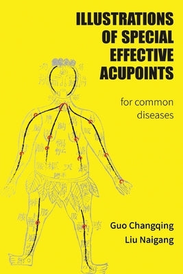 Illustrations Of Special Effective Acupoints for common Diseases by Guo, Changqing