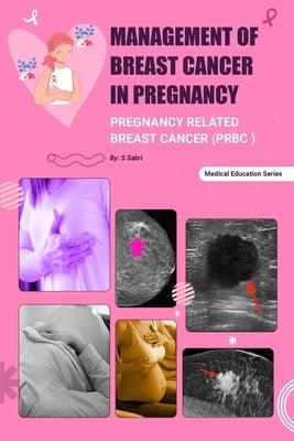Management of Breast Cancer in Pregnancy: Pregnancy related Breast Cancer (PRBC) by Sabri, S.