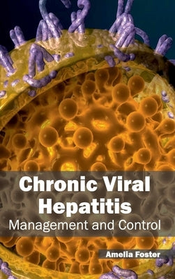 Chronic Viral Hepatitis: Management and Control by Foster, Amelia