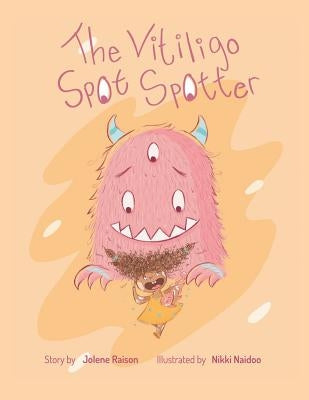 The Vitiligo Spot Spotter by Raison, Jolene