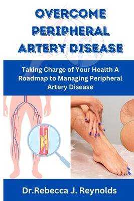 Overcome Peripheral Artery Disease: Taking Charge of Your Health A Roadmap to Managing Peripheral Artery Disease by Reynolds, Dr Rebecca J.