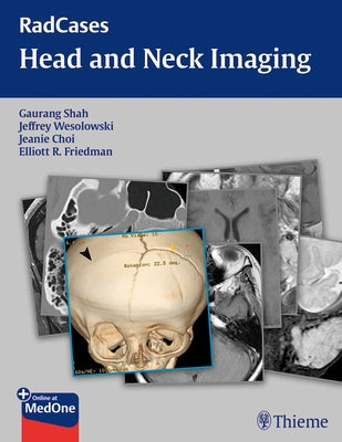 Radcases Head and Neck Imaging by Shah, Gaurang